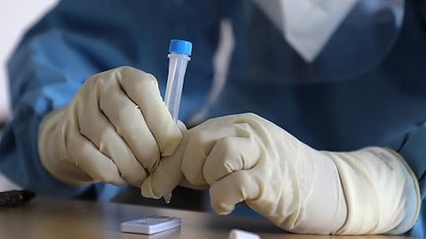 Detectan cuatro casos de Flurona en Michoacán