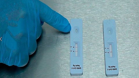 No se reportan pacientes intubados