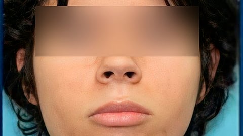 Salvador debía soportar las burlas de su compañeros que bromeaban con su tartamudez y su seseo, contó un amigo