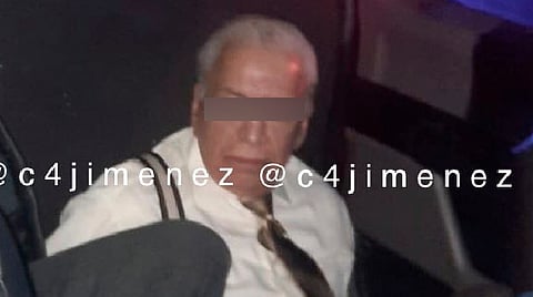 Jesús "N" presuntamente le disparó a su esposa en tres ocasiones