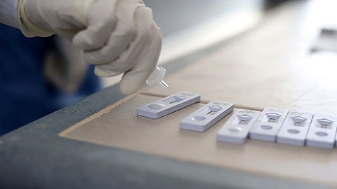 La intención es brindar un diagnóstico oportuno de la enfermedad a toda la población que lo requiera