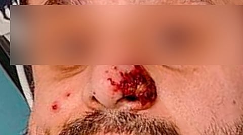 La evolución del paciente se ha presentado positivamente sin riesgo de muerte