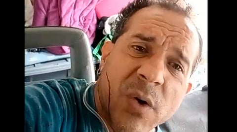 Conductor queda prensado tras accidente y pide ayuda por Facebook Live en Puebla