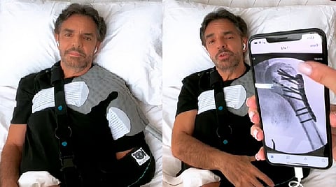 Fue el 29 de agosto que se informó que el comediante había sufrido un accidente