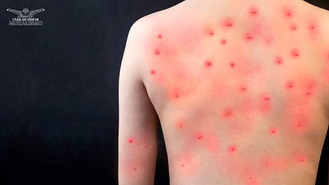 En Michoacán se registran 7 casos