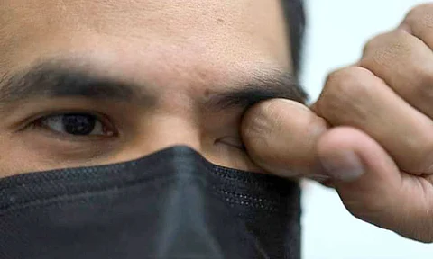 ¿Ojos rojos o picazón? Podría ser conjuntivitis, advierte SSM