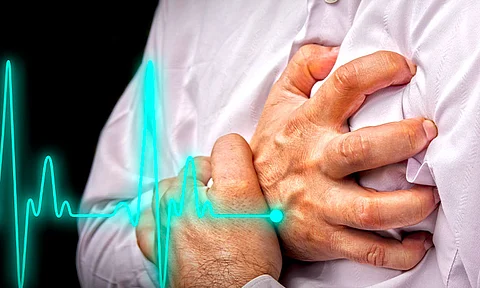 El infarto al miocardio emerge como una preocupación central en el panorama de la salud en el país