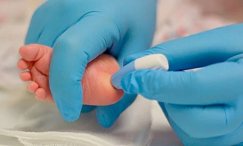 Centros de salud de la SSM aplican sin costo el tamiz neonatal