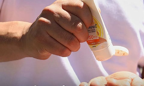 Usar bloqueador solar ayuda a prevenir quemaduras por el sol: SSM