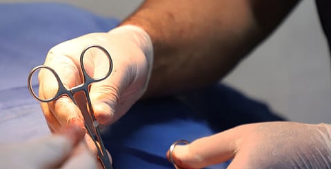 ¿Paternidad satisfecha? SSM realizará en Uruapan vasectomías sin bisturí