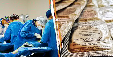 Ofrece SSM vasectomías y preservativos gratuitos en centros de salud