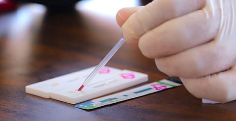 Realiza SSM pruebas rápidas y gratuitas de hepatitis C, VIH y sífilis
