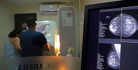 Reconoce los síntomas del cáncer de mama para actuar de inmediato