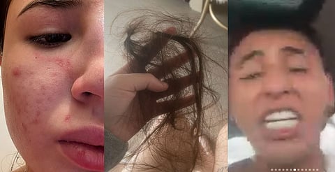 Fer Durán saca pruebas de violencia supuestamente por parte de Lapizito