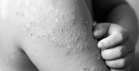 Autoridades sanitarias reiteran llamado urgente a la vacunación
