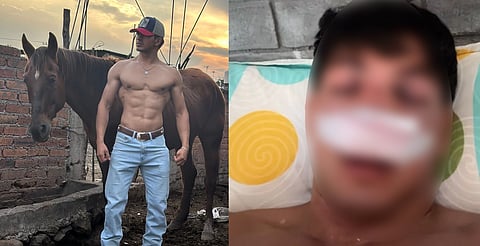 Se accidenta tiktoker michoacano El Pepin Jr; no puede pasar agua ni alimentos