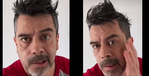 Carlos Espejel revela que sufre parálisis facial por estrés