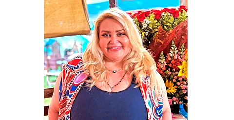 Sheyla dona su piel a niños quemados tras perder 58 kilos