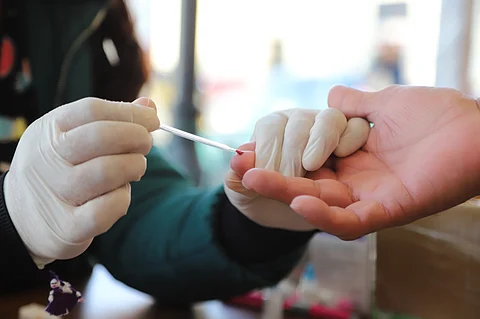 SSM realiza pruebas gratuitas de VIH en centros de salud