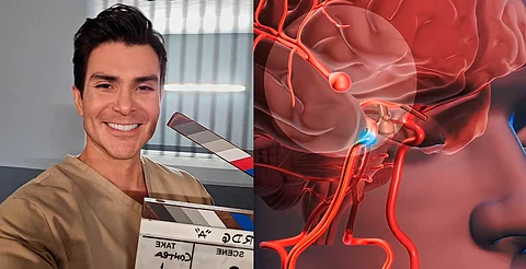 Qué es un aneurisma cerebral, lo que le arrebató la vida al actor Juan Carlos Ramírez