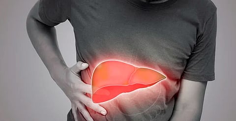 ¿Tienes hígado graso? Así puedes revertirlo comiendo bien