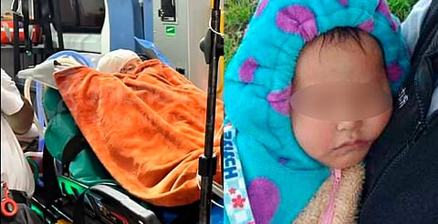 Bebé Jazlyn fue operada, evalúan zonas de injerto; su estado es crítico pero estable