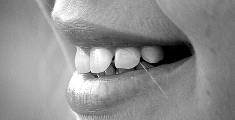 Una dieta rica en calcio y vitamina D fortalece dientes y huesos