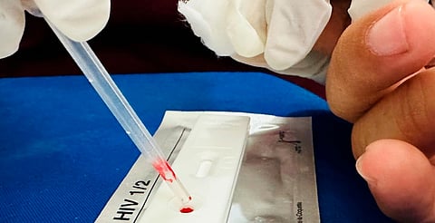 Más de 40 millones viven con VIH en el mundo, pero la ignorancia sigue propagándose