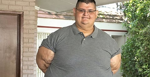 Fallece Juan Pedro Franco, quien fue el hombre más obeso del mundo