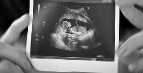 Embarazo adolescente, el reto de salud pública y de equidad social en Michoacán