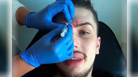 Su primera cirugía estética se la practicó cuando tenía solo 17 años de edad (Foto:Twitter @JamesHoltx)