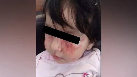 La explicación que se les dio a los familiares fue que se quedó sola con un compañero que ya ha rasguñado antes