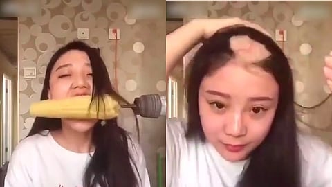 Pasará un tiempo antes de que la joven pueda dejar de usar gorra