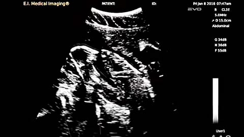 El video de este milagro de la vida, cuenta con más de 200 mil reproducciones en Internet