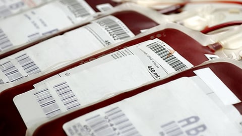 Donar sangre no implica ningún riesgo para la salud (Foto: Cortesía)