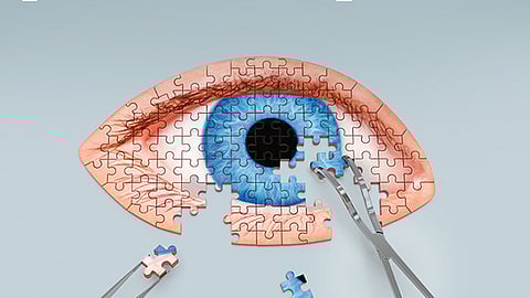 Foto Ilustrativa (Facebook:
@clinicadeojosmty)