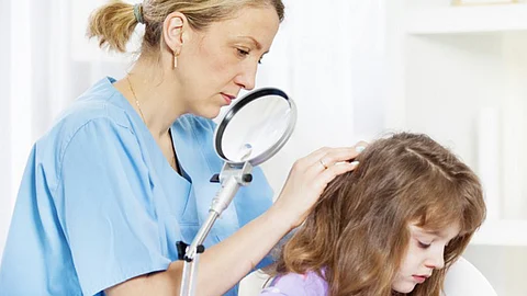 La forma de identificar si los niños ya están infestados es buscar la liendre, que es la parte previa al piojo y que normalmente se desarrolla atrás de los oídos y en la nuca (Foto: Istock)
