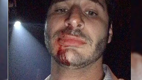 Un sujeto lo atacó con un vaso (Foto: Ryan Hoffman)
