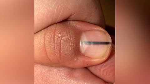 La manicurista pidió hacer pública la imagen para alertar sobre el mal (Foto Facebook: Lisa Harrison Williams)