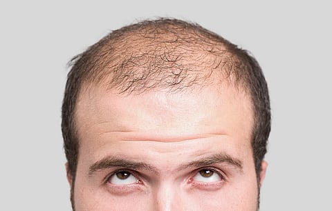 Close up of bald young man, front view