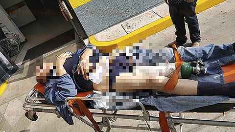 De acuerdo con voces oficiales, la víctima sufrió lesiones de proyectil de arma de fuego en la cadera (Foto: RED 113)