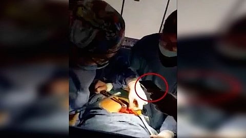 El hecho fue grabado por uno de los doctores que permanecía en la sala de operación (Foto: captura)