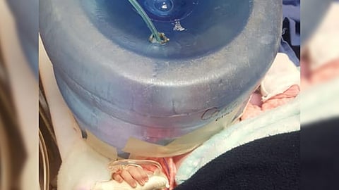 Ha causado polémica en redes el uso de un garrafón de plástico, a modo de “casco de oxígeno” improvisado para salvar la vida de la bebé (Foto: Facebook/Maripoza Monarka)