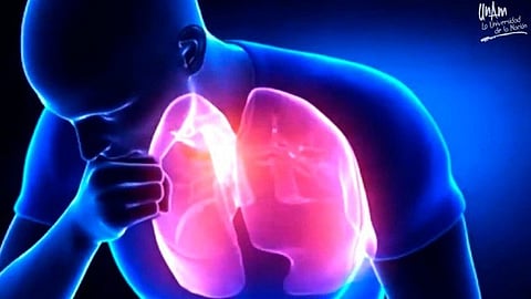 Se manifiesta con fiebre, neumonía y granulomas (Foto: UNAM)