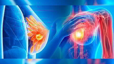 Este tratamiento no afecta significativamente la viabilidad celular en líneas celulares
no cancerosas NOVA (Foto: Ilustrativa/https://newsarchive.heart.org)