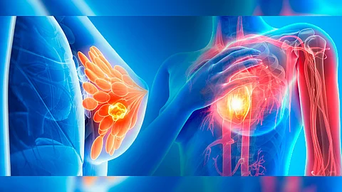 Este tratamiento no afecta significativamente la viabilidad celular en líneas celulares
no cancerosas NOVA (Foto: Ilustrativa/https://newsarchive.heart.org)