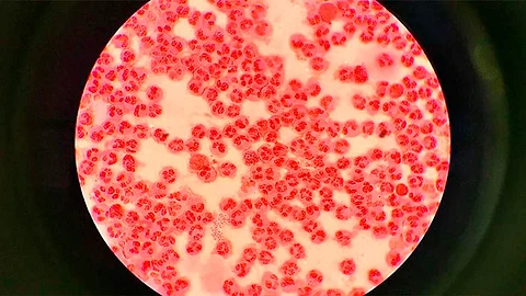 El uso de condón en las relaciones sexuales es la única forma de prevenir esta infección
(Foto: gen-es.org)