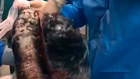El paciente tenía 52 años de edad (Foto: Captura)