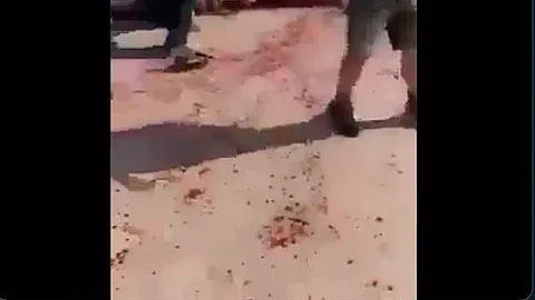 El propio ministro de salud de Jordania se encargó de operar a la ciudadana mexicana (Foto: captura)