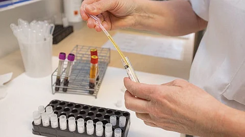 En el país son ya 53 casos confirmados (Foto: OMS)